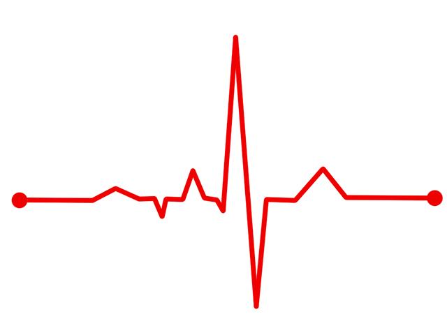 User Experiences: Real-World‍ Insights on⁢ Heart Rate Monitors During Workouts